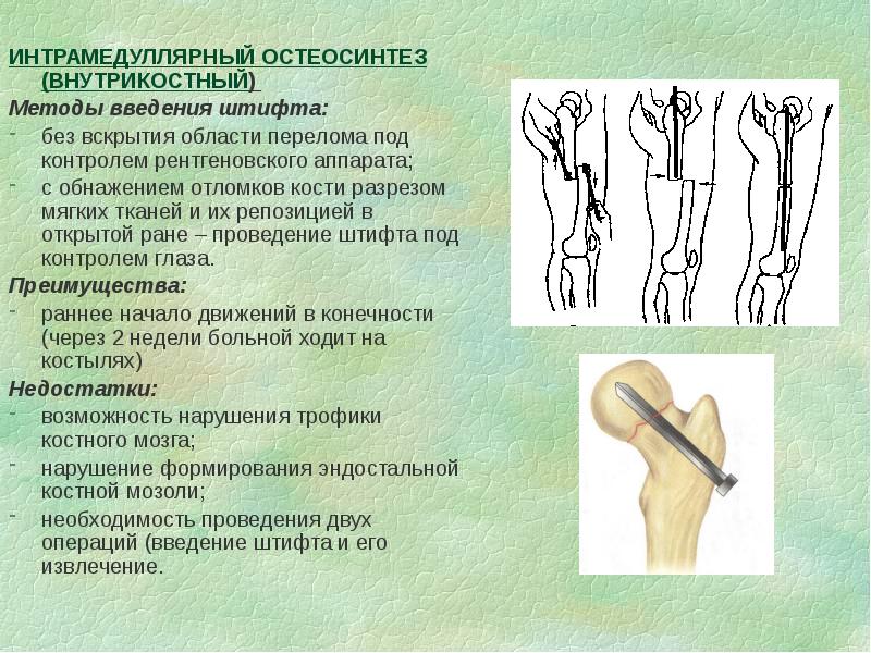 Оперативная хирургия нижней конечности презентация