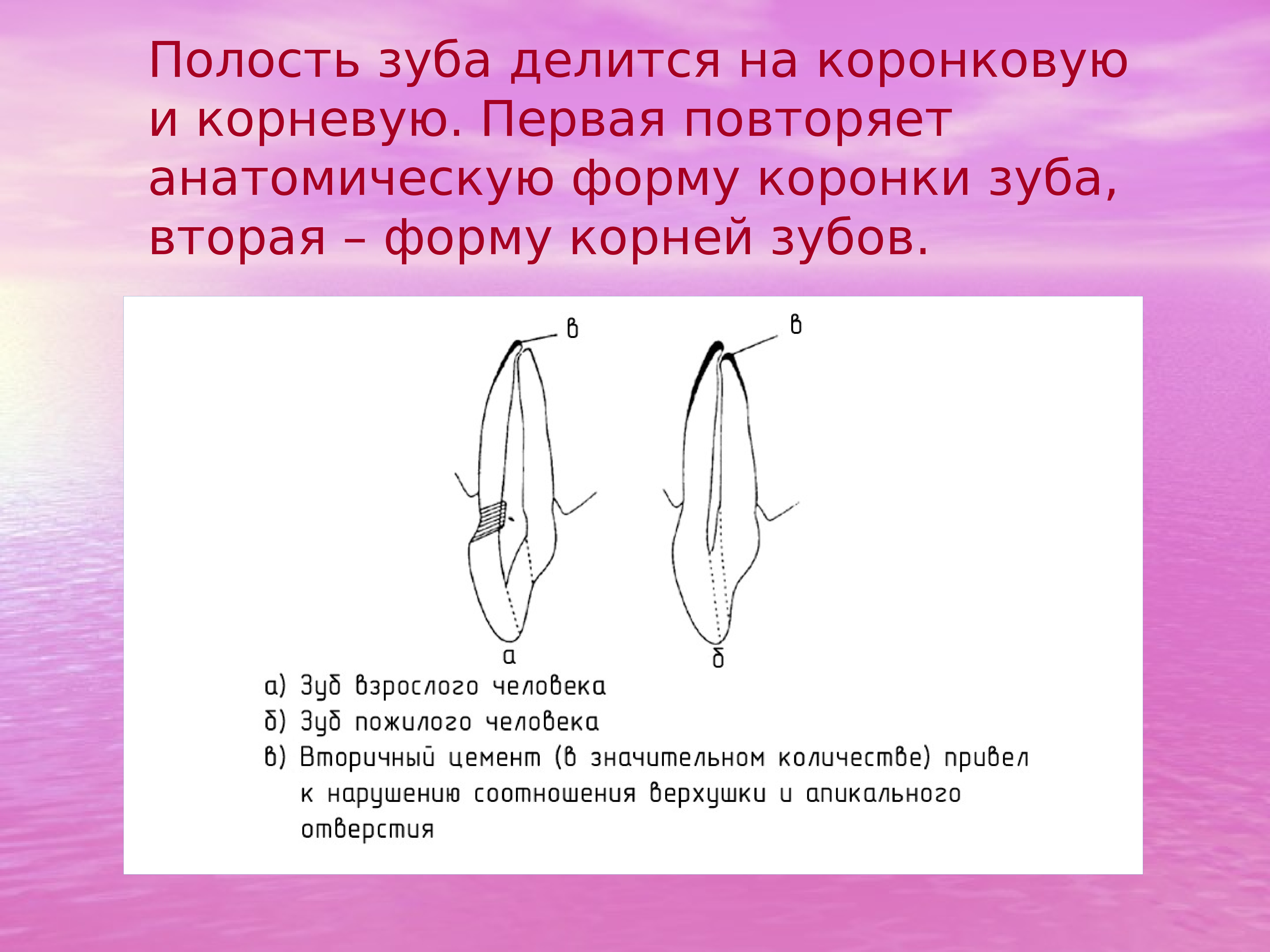 Полость зуба. Раскрытая полость зуба повторяет анатомическую форму. Полость зуба делят на. Коронковые полости зубов.