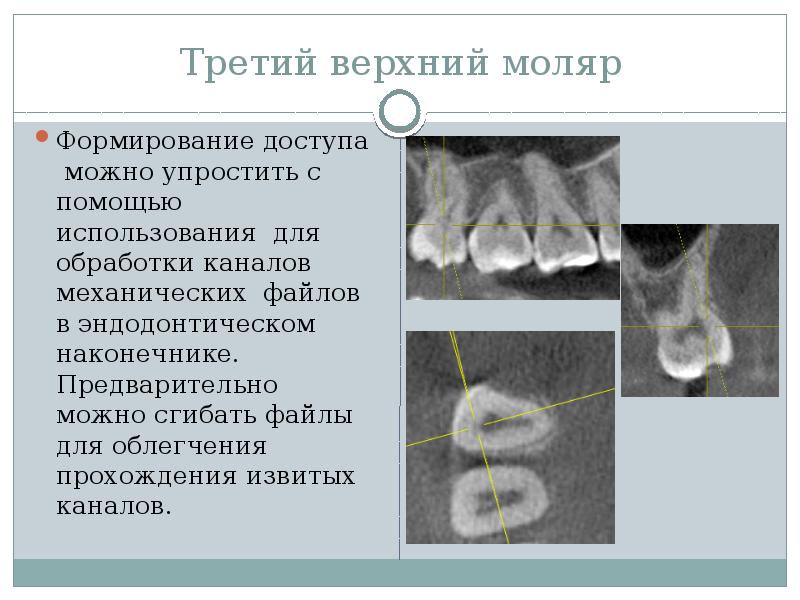 Презентация на тему морфология