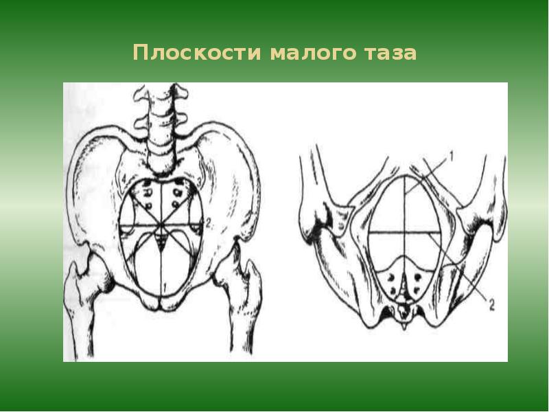 Размеры плоскостей малого таза