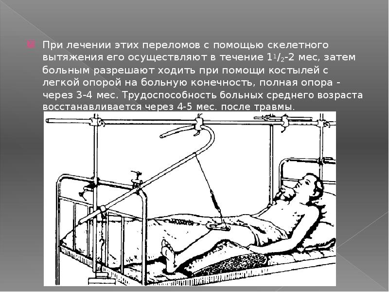 Скелетное вытяжение презентация