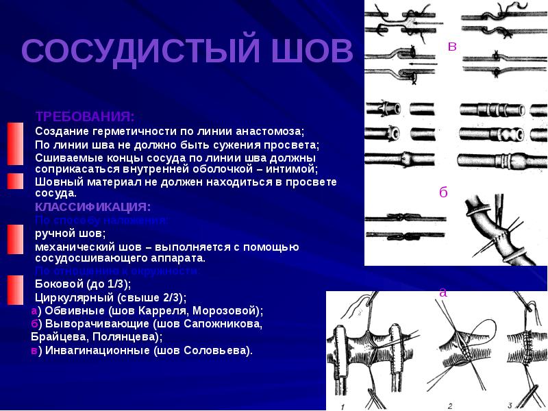 Сосудистый шов презентация