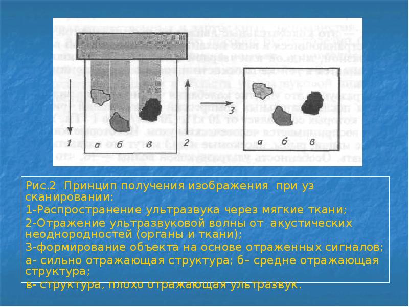 Принципы получения ультразвукового изображения сердца в трех режимах сканирования