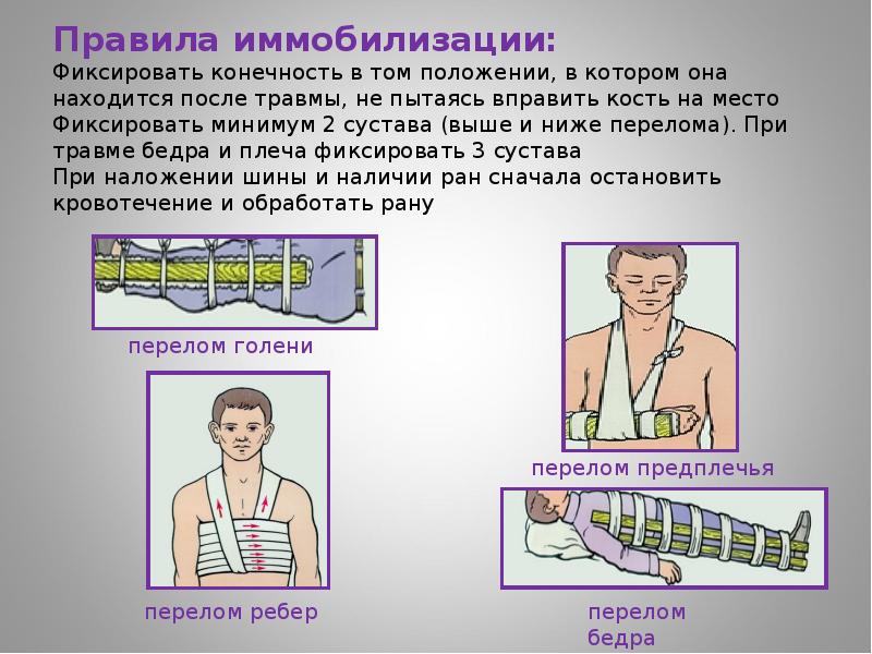 Первая помощь при переломах презентация