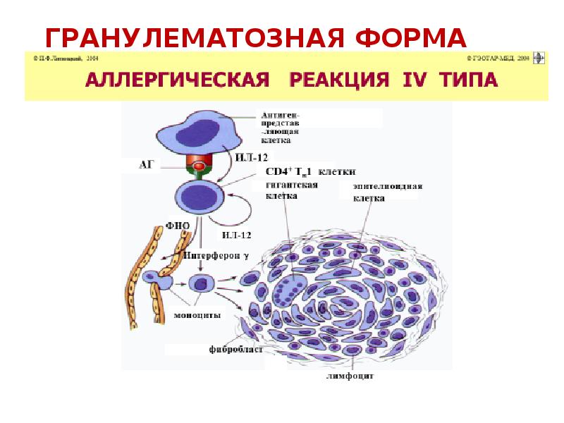 Типы аллергических реакций презентация