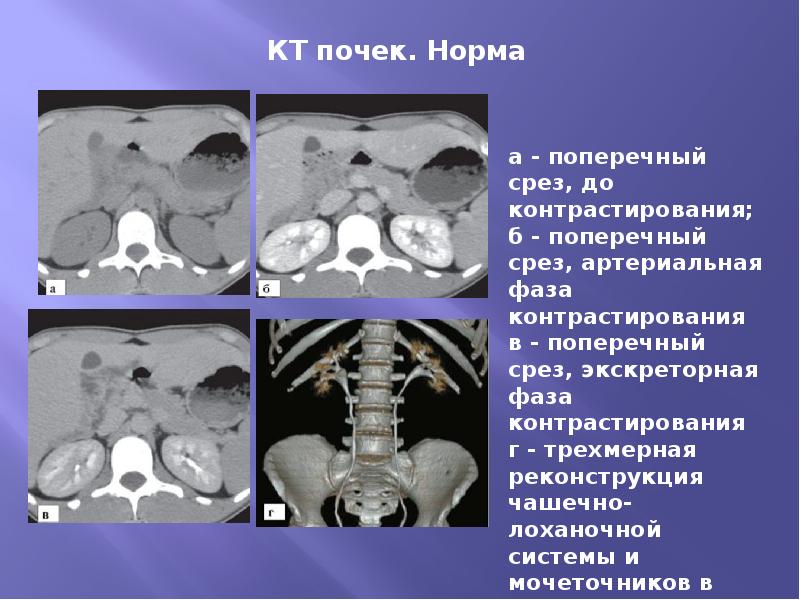 Лучевая диагностика мочевыделительной системы презентация