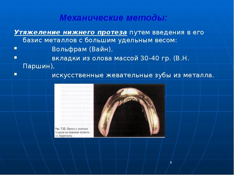 Вкладки ортопедическая стоматология презентация