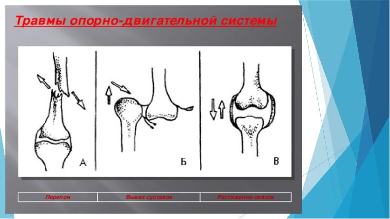 Железнодорожная травма презентация