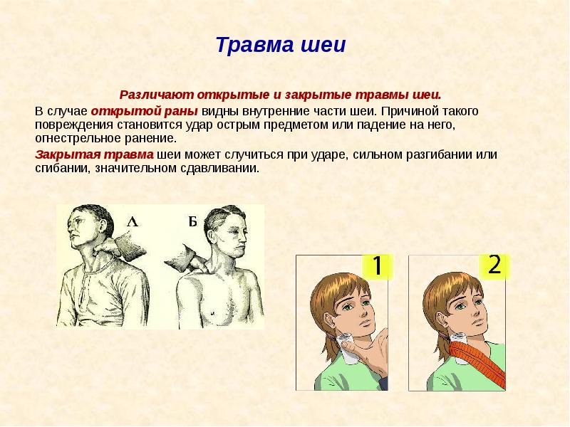 Укажите признаки травмы шеи. Симптомы повреждения шеи.