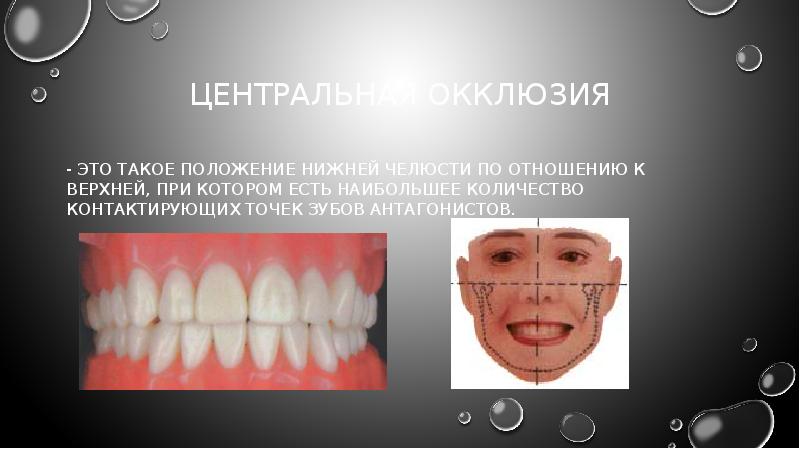 Презентация методы определения центрального соотношения челюстей