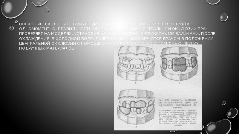 Определение центральной окклюзии при частичном отсутствии зубов презентация