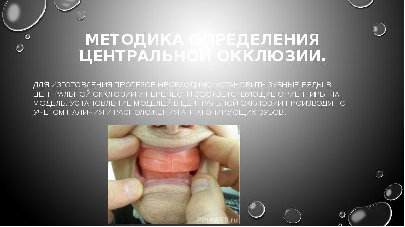 Презентация методы определения центрального соотношения челюстей