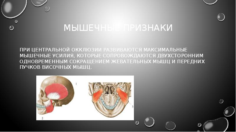 мышечные признаки
при центральной окклюзии развиваются максимальные мышечные усилия, которые сопровождаются мышечные признаки
при центральной окклюзии развиваются максимальные мышечные усилия, которые сопровождаются