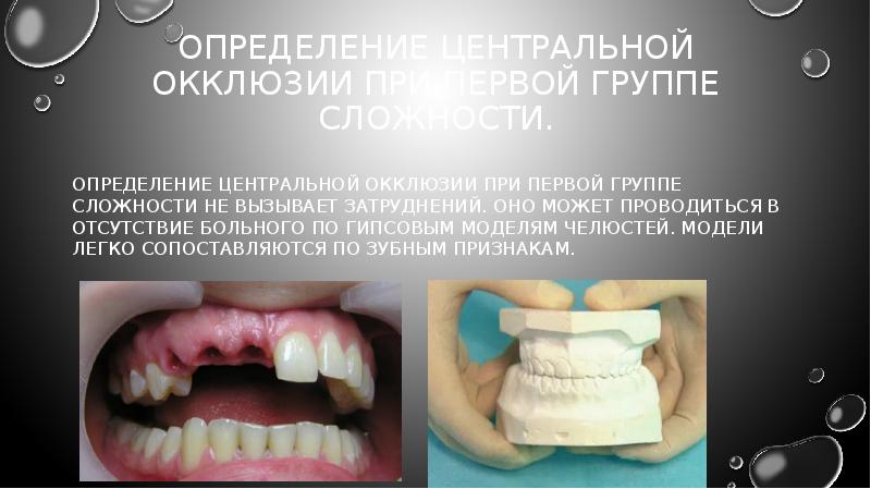 Определение центральной окклюзии при частичном отсутствии зубов презентация