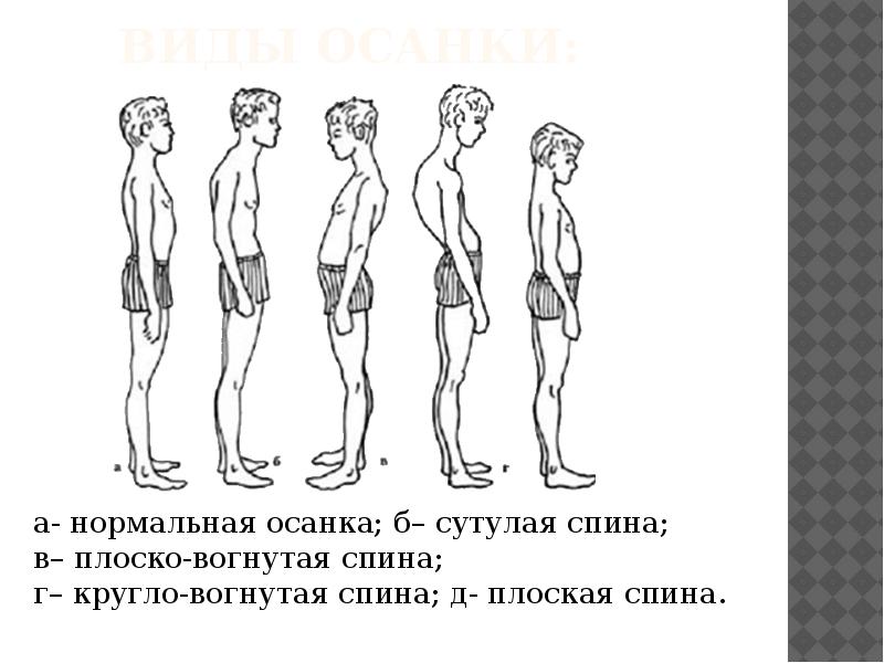 Картинки плоская спина