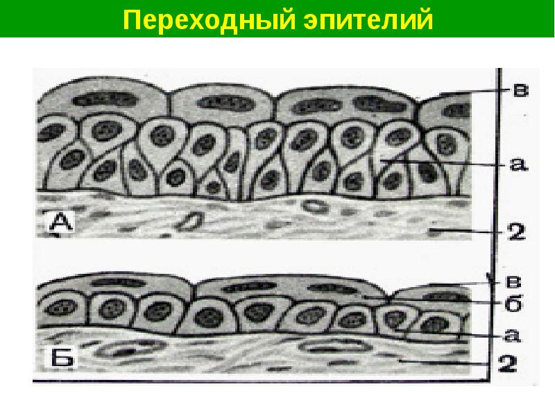 Переходный эпителий рисунок