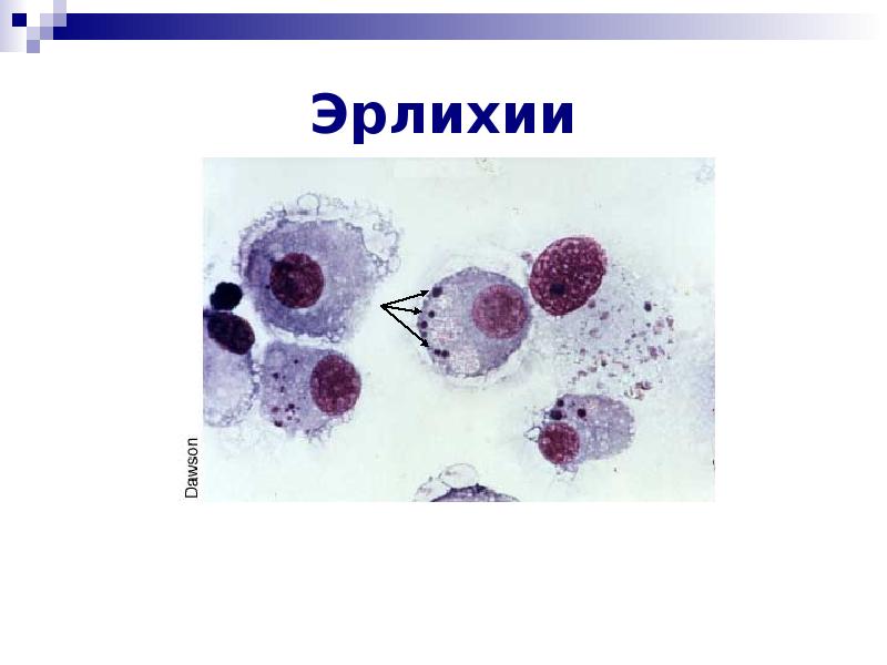 Моноцитарный эрлихиоз человека что это. Моноцитарный эрлихиоз человека. моноцитарный эрлихиоз человека (мэч). моноцитарный эрлихиоз человека фото.
