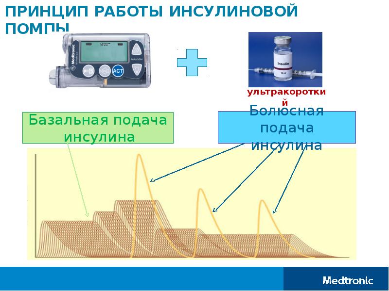 Инсулиновые помпы презентация