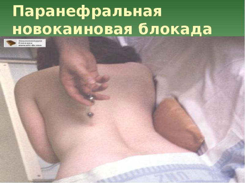 Сестринская помощь при мочекаменной болезни презентация