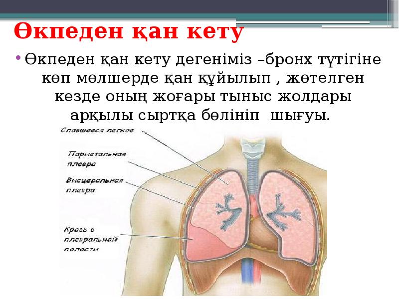 Презентация қан кету