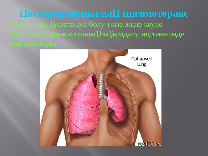 Кеуде жарақаттары презентация