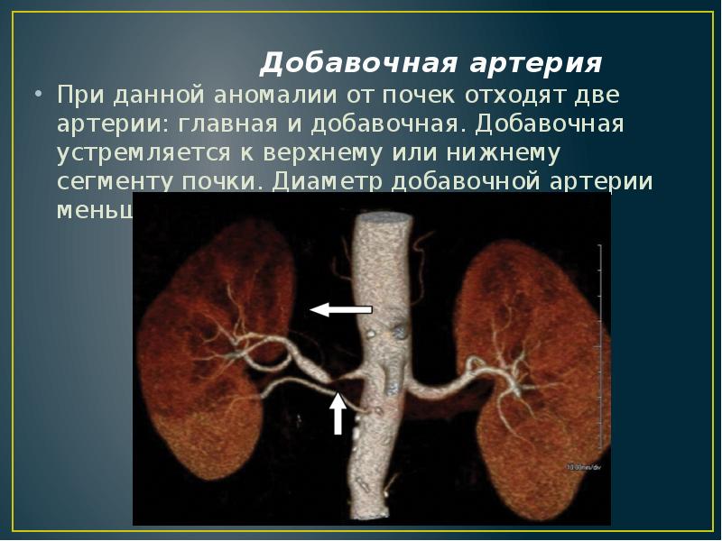 Аномалии мочеполовой системы презентация