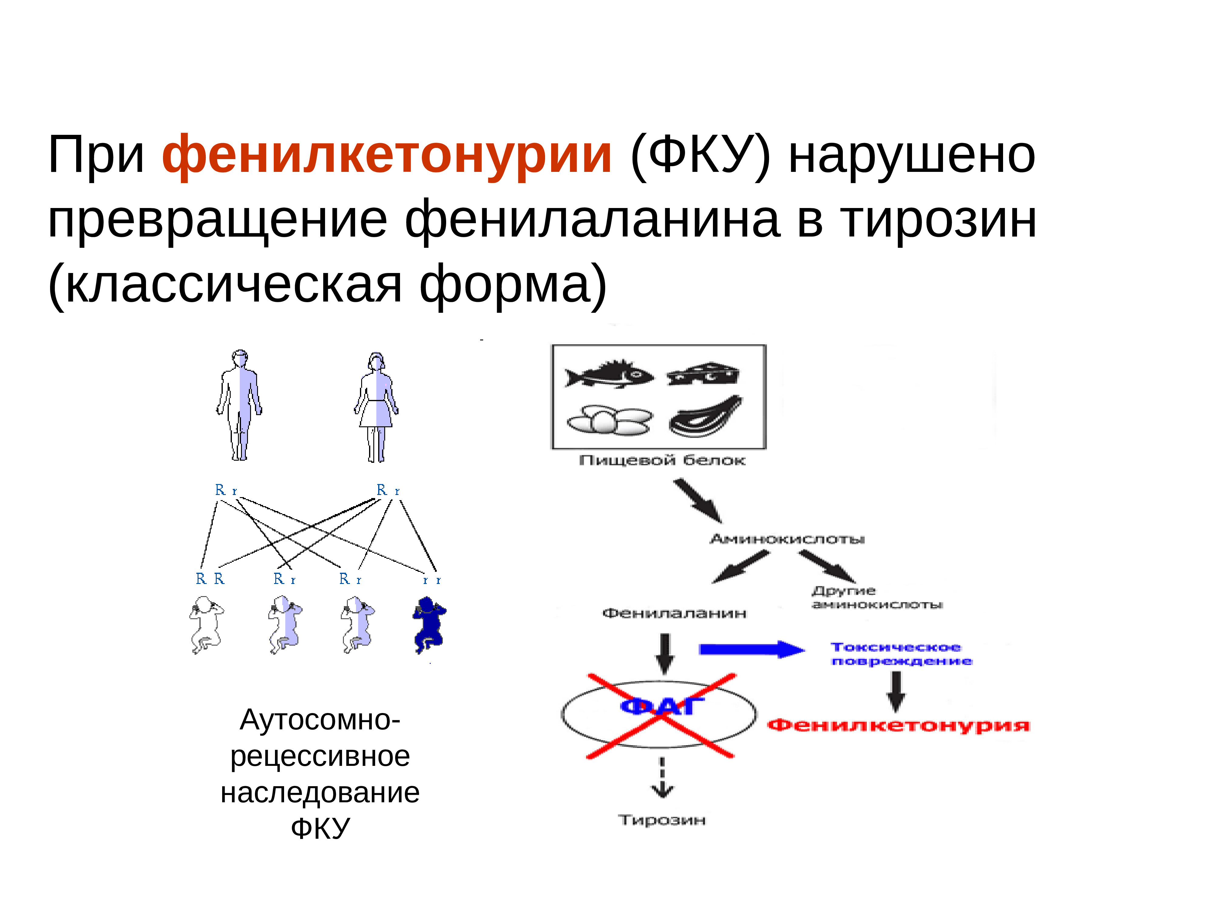 Фенилкетонурия генотип. Схема наследования фенилкетонурии. Механизм развития фенилкетонурии схема. Фенилкетонурия патогенез. Фенилкетонурия генетика.