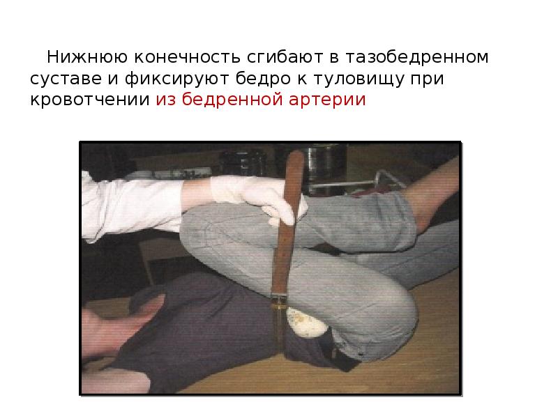 Мышцы сгибатели и разгибатели руки. Задняя группа разгибателей предплечья. Косыночная повязка, поддерживающая верхнюю конечность. Наложение жгута и повязки. Движение в локтевом суставе мышцы.