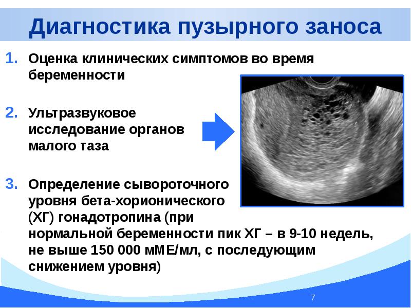 Нормальная беременность клинические рекомендации презентация