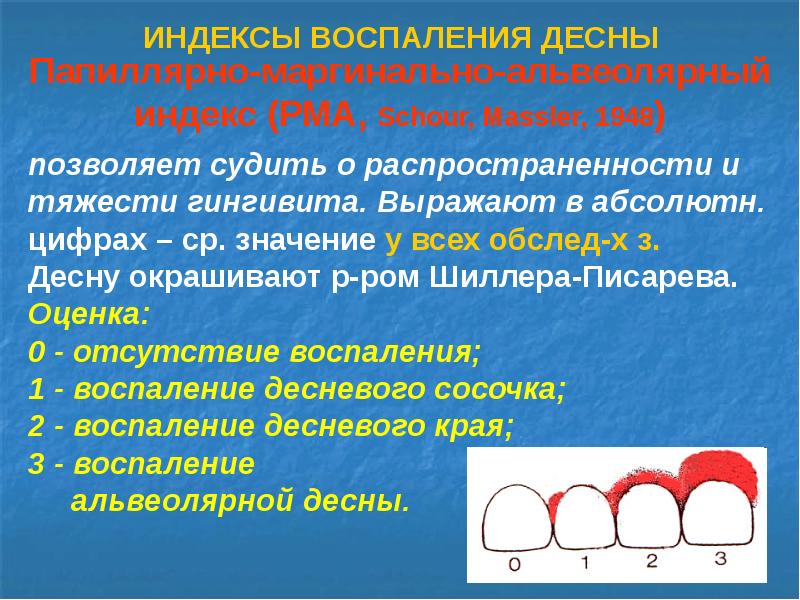 Индексы пародонта. Папиллярно маргинально альвеолярный индекс. Индекс PMA. Индекс гингивита РМА.