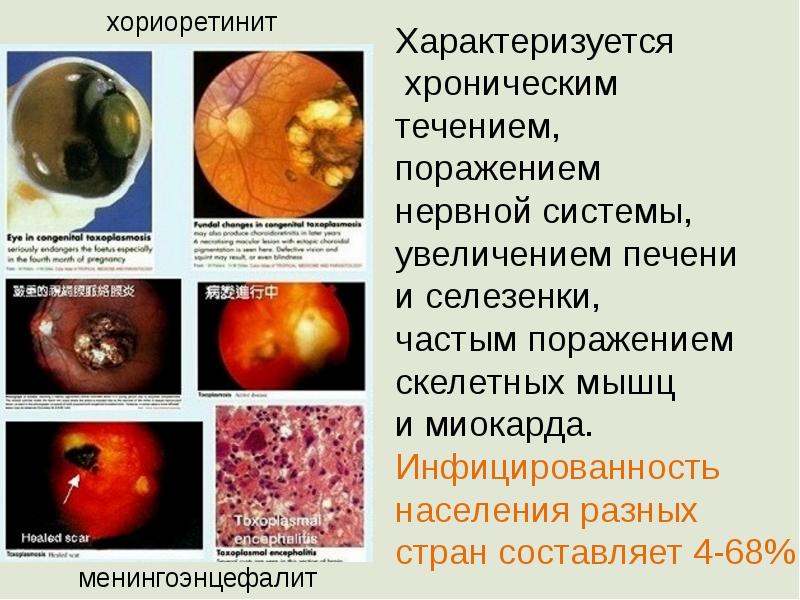 Медицинская протозоология презентация