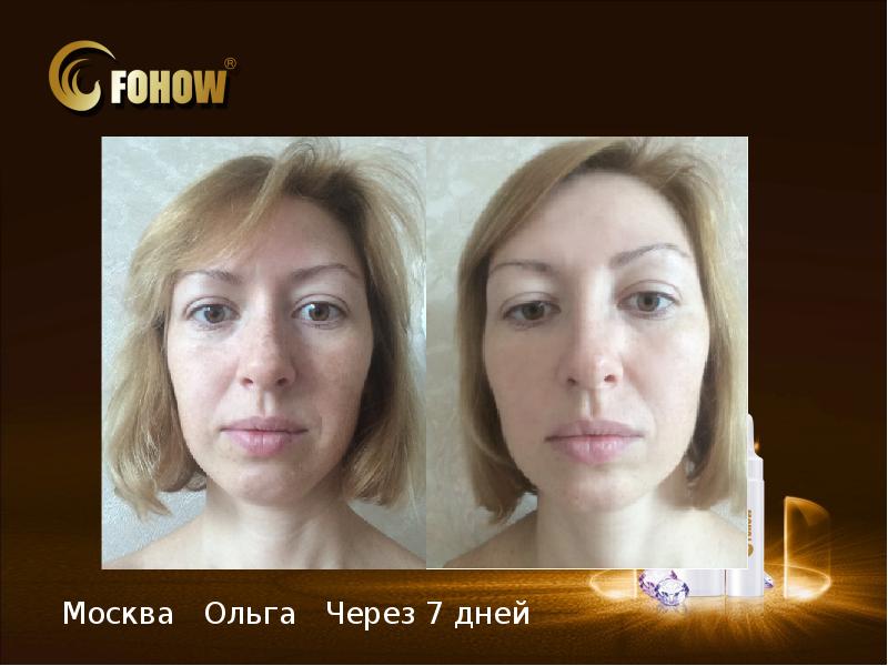 Результат после массажа лица фото до и после