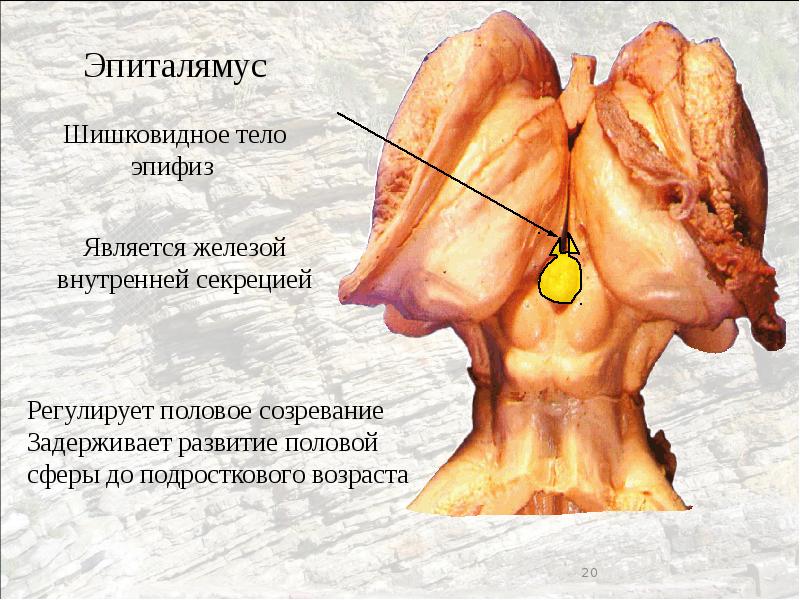 Шишковидная железа. Шишковидное тело железа внутренней секреции. Шишковидная железа где находится. Активная шишковидная железа. Эпифиз Мазары.