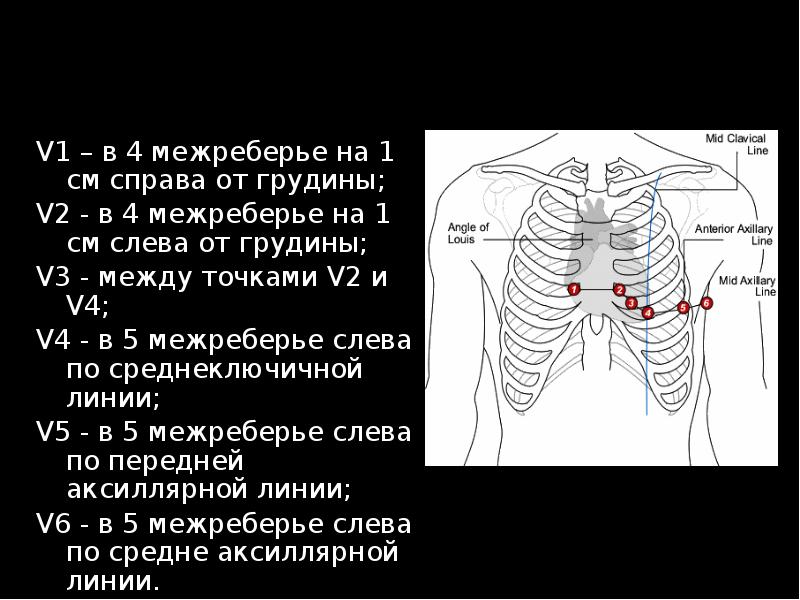 Справа грудной клетки