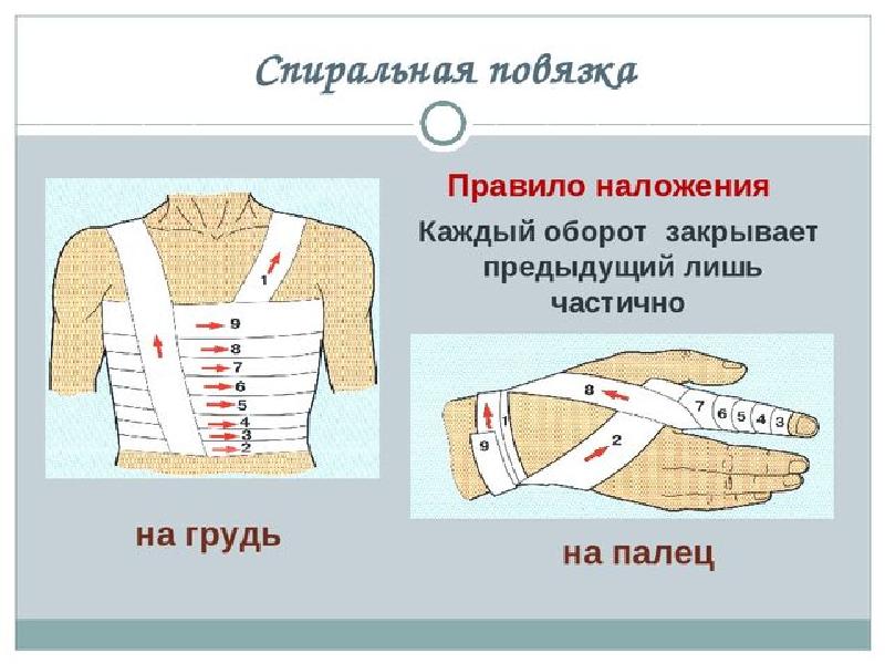 Перевязки хирургия презентация