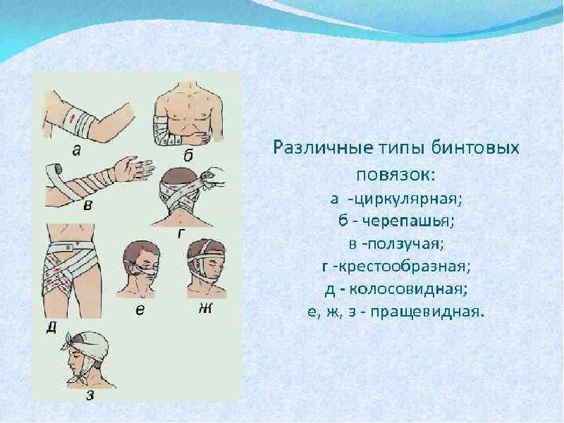 Повязка гаязова. Типы бинтовых повязок. Типовые бинтовые повязки. Различные типы повязок. Основные типы бинтовых повязок.