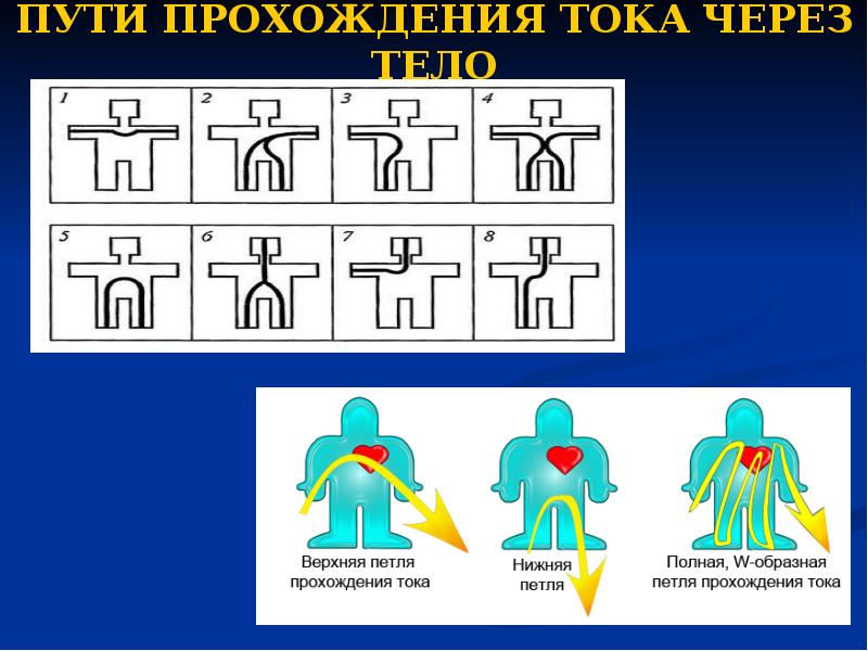 Прохождение электрического тока. . Возможные пути прохождения тока через тело человека:. Петли прохождения тока. Самый опасный вариант прохождения тока через человека. Петля электрического тока.