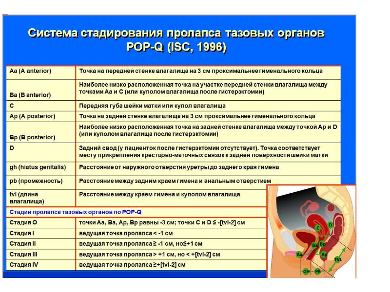 Пролапс тазовых органов презентация