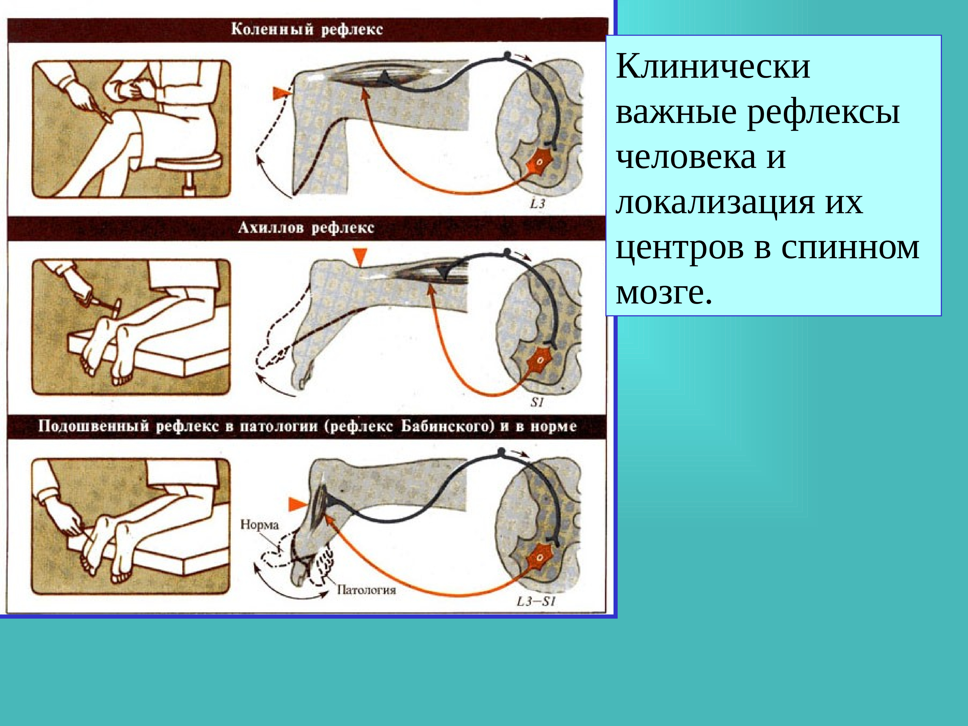 Схема рефлекторной дуги ахиллова рефлекса с обозначениями