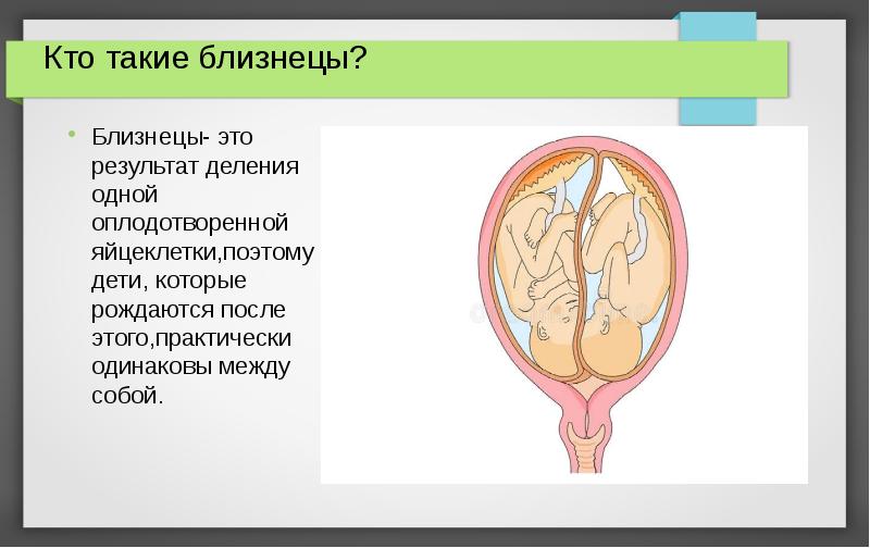 Что такое быть близнецом. Что такое быть близнецом