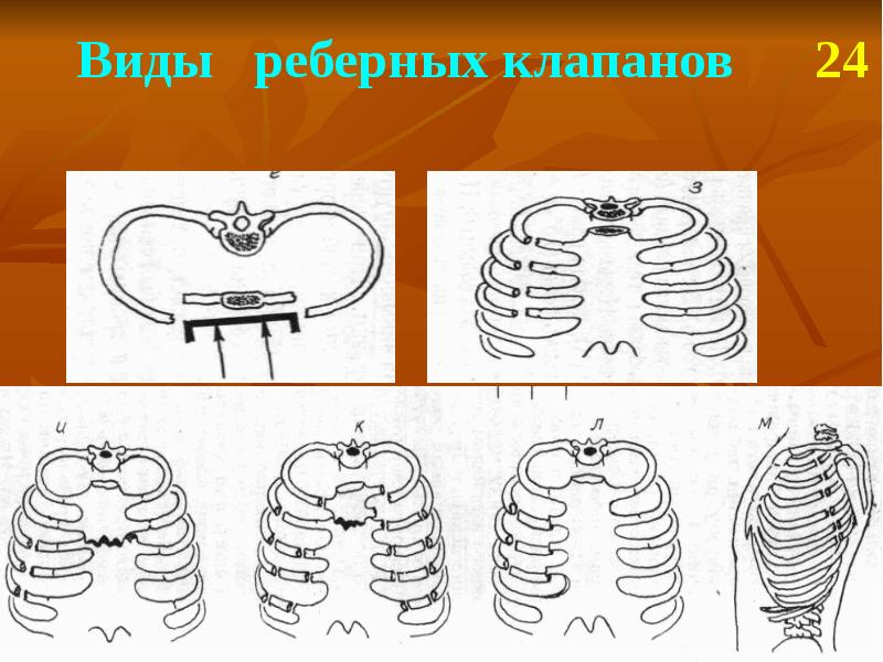 Травмы грудной клетки презентация