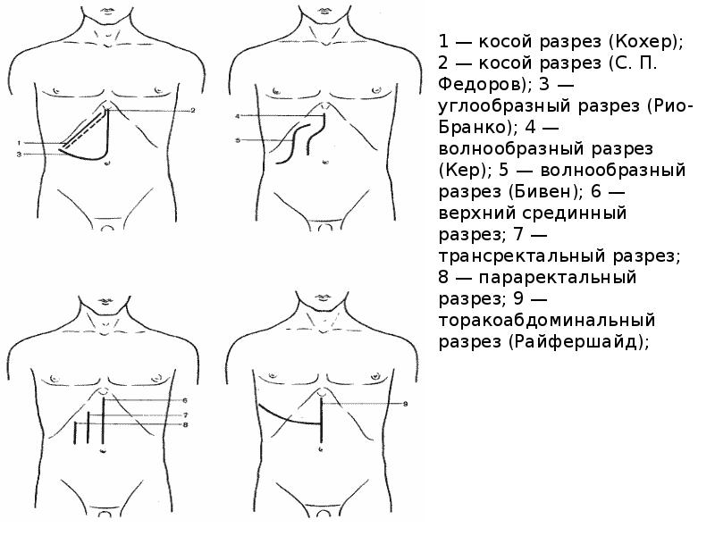 Мобилизация 12 перстной кишки по кохеру схема