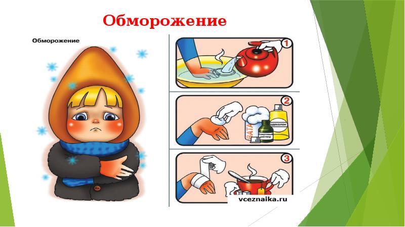Обморожение Обморожение