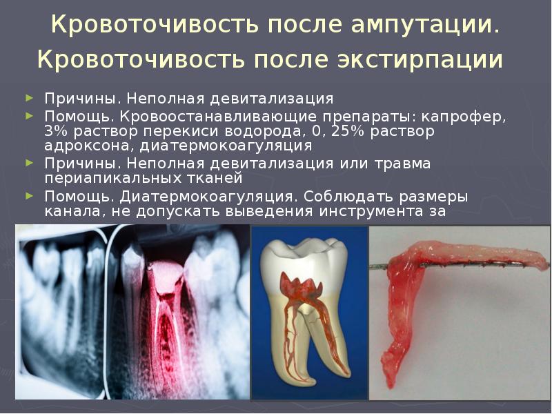 Хронический пульпит презентация