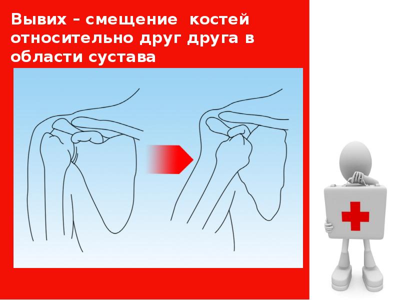 Смещение суставных концов костей относительно друг друга. Травмы различных областей тела.