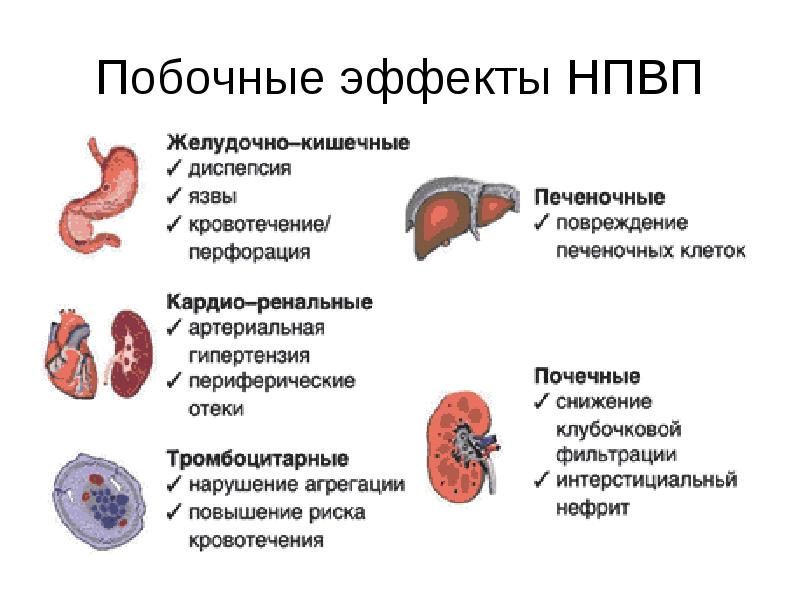 Побочные действия бад. НПВС осложнения приема. Нестероидные противовоспалительные препараты осложнения. Нестероидные препараты побочные эффекты.