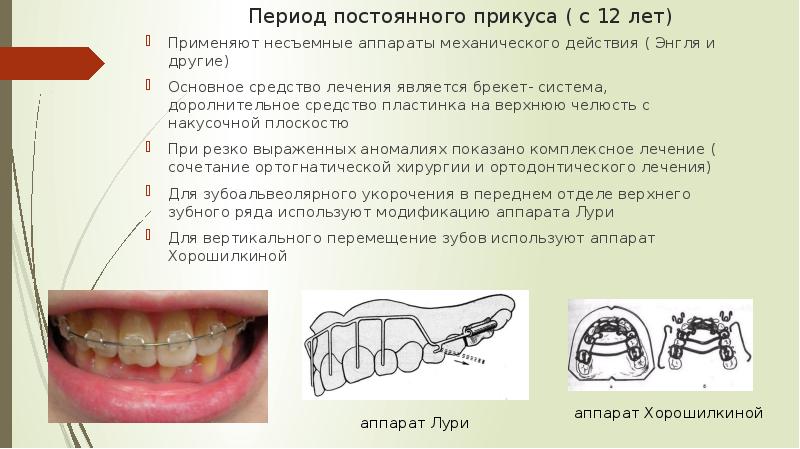 Презентация ортодонтические дуги