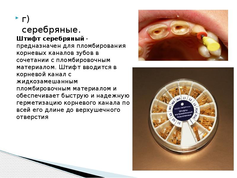 г) серебряные.
г) серебряные. г) серебряные.
г) серебряные.