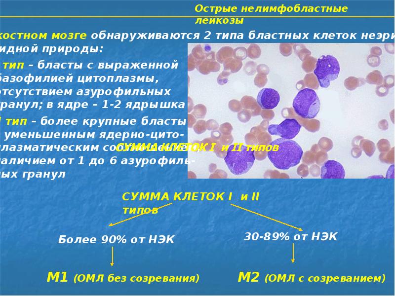 Острый миелолейкоз презентация