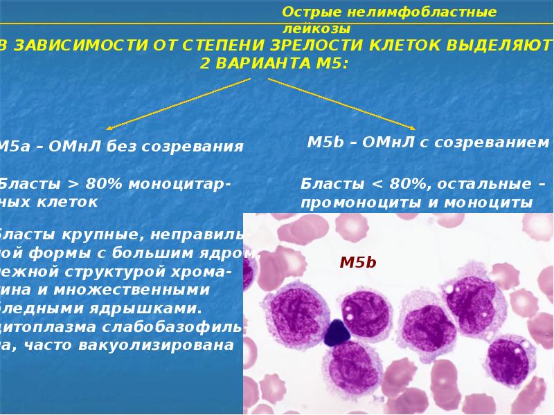 Острый миелолейкоз презентация